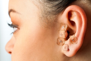 Terapia auricular o acupuntura del oído en Norcross, GA